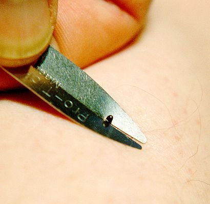 Pro-Tick Remedy 6-Pak - Effective Tick Remover for Cats, Dogs, Horses, and Humans - Safe for All Pets