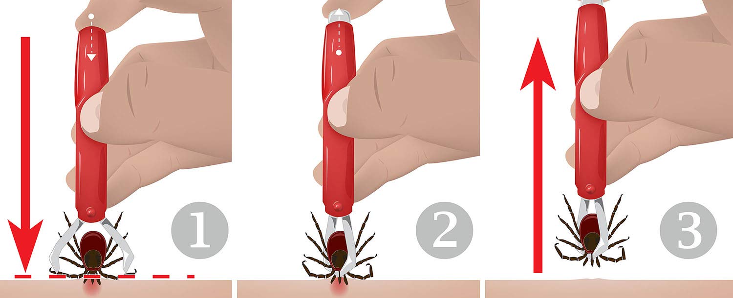 valonic tick Remover, 2 Pack - red, tick Removal Tool - tick Remover for Dogs and Cats