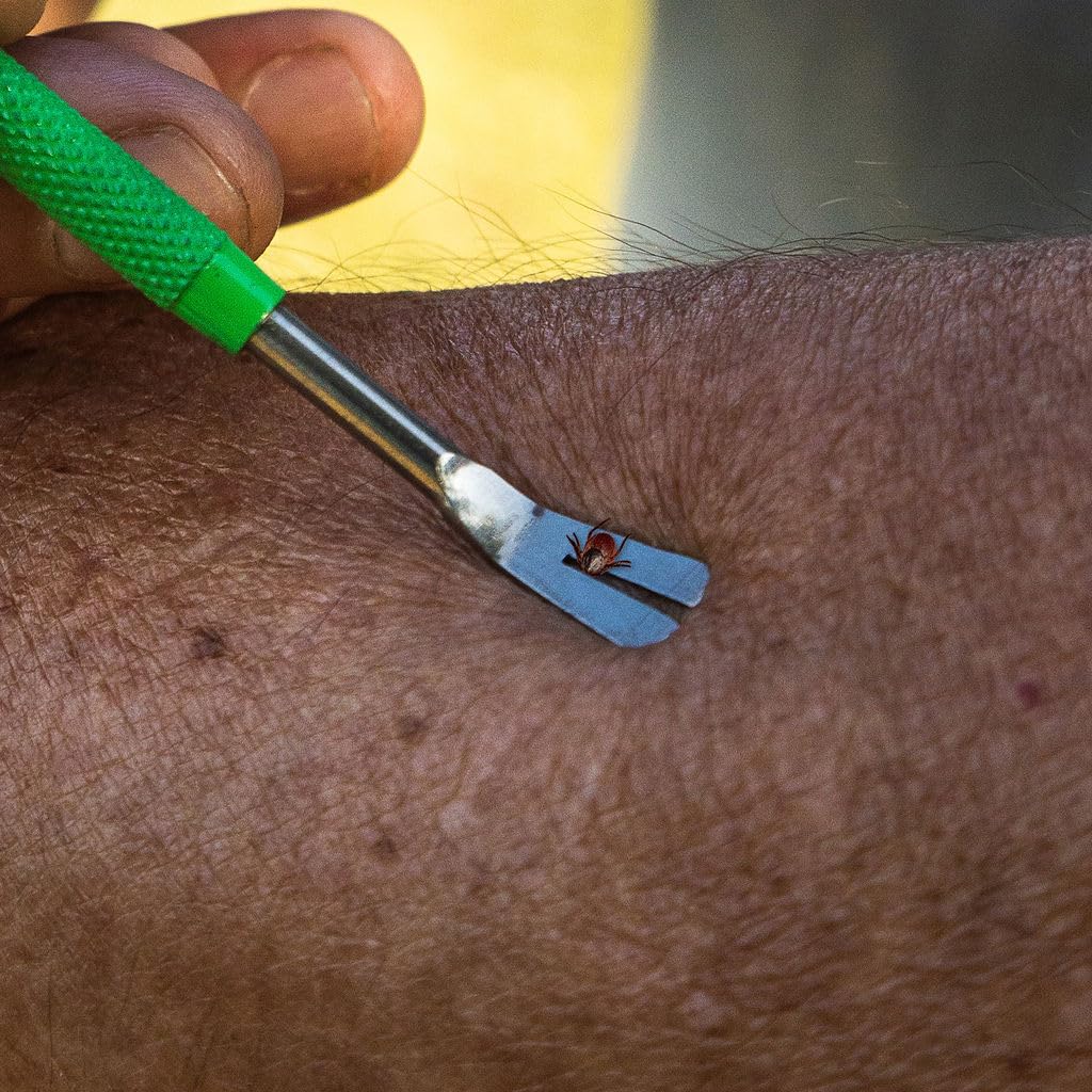 Tickcheck Premium Tick Remover Kit - Stainless Steel Tick Remover + Tweezers, Leather Case, And Free Pocket Tick Identification