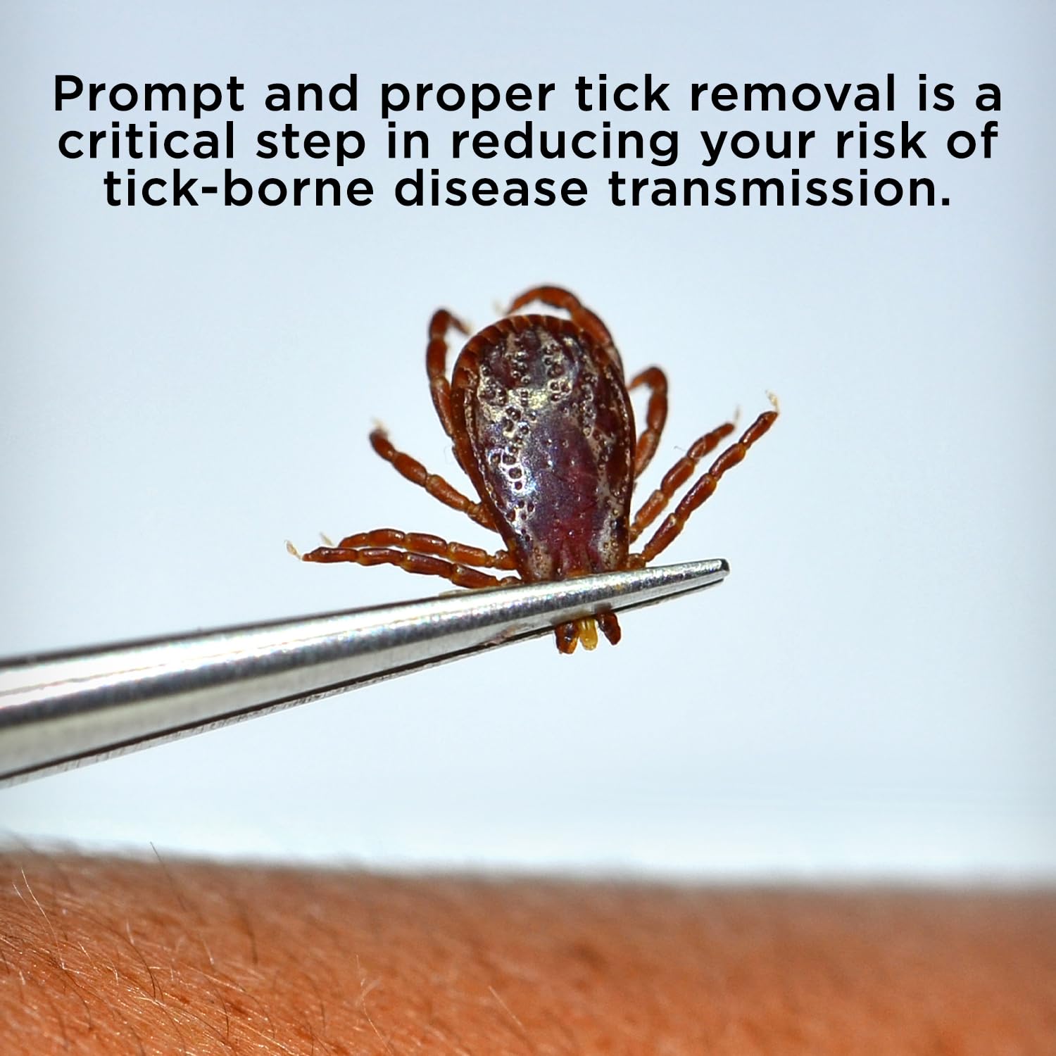 Bug Bite Thing Tick Remover Tool For People & Pets, Patented Two Sided Stainless Steel Design With Fine Tipped Tweezers, Formerl