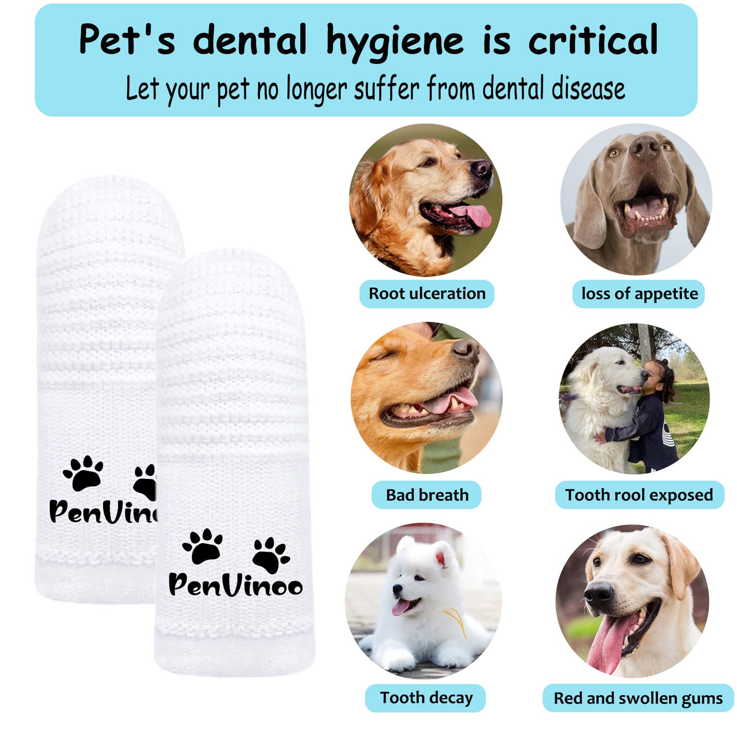 20 PCS Pet Dog Soft Toothbrush - Finger Toothbrush for Small to Large Dogs