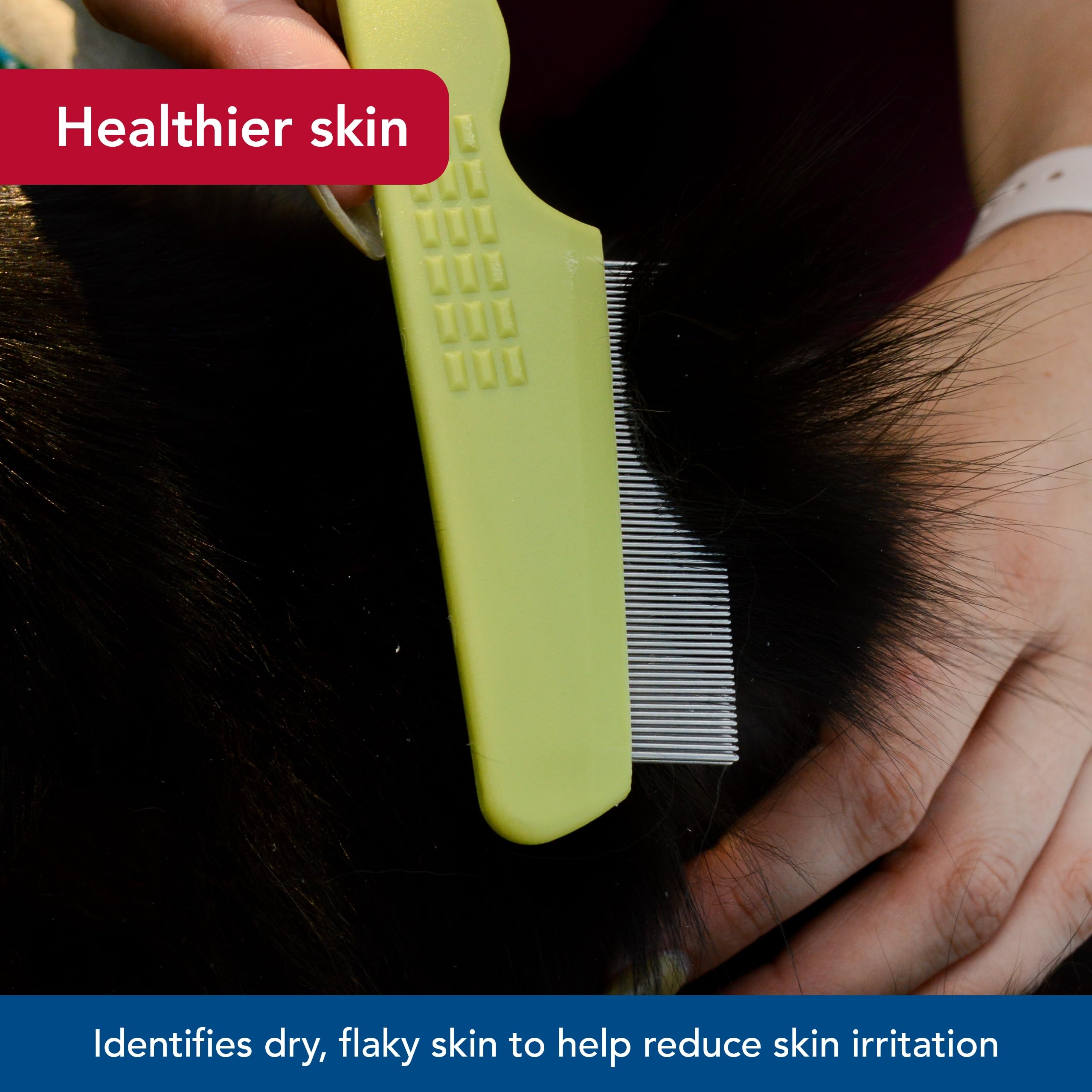 Coastal Pet Safari Cat Flea Comb - Tick & Flea Comb For Cats - Avoid Dry Skin - One Size