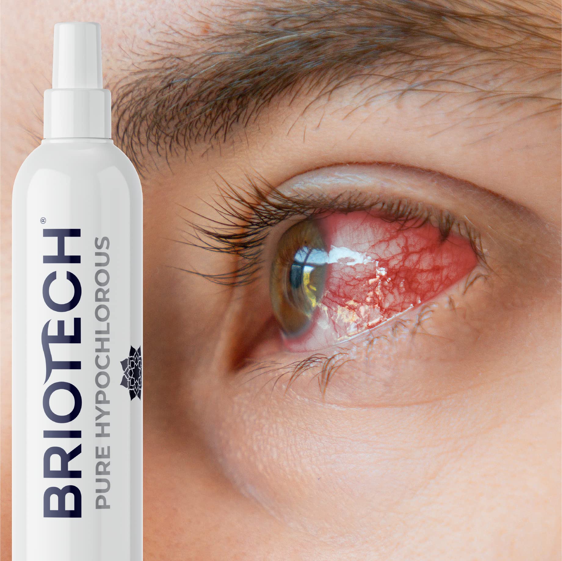 BRIOTECH Pure Hypochlorous Multi-Purpose Cleanser, 1 Gallon (Pack of 4), Family Approved, Pet Friendly, Model PURE-1G-4EA